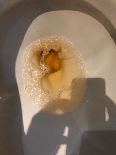 凌晨测的验孕棒准吗(下午三点测验孕棒准吗）