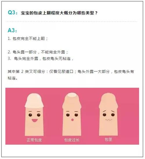 割包茎水肿多久能好(隐茎手术拆环后水肿多久能好）