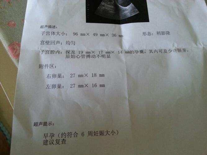 优生五项和优生十项(优生十项结果解读）