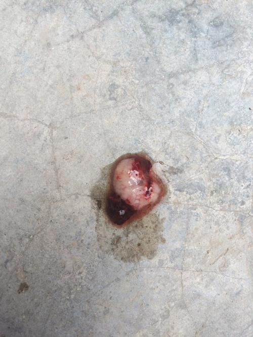 同房30天孕囊多大(同房即受孕20天孕囊有多大）