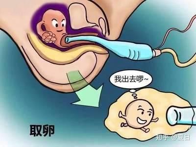 取卵要空腹吗取卵不能吃东西吗?(取卵后可以吃东西吗)
