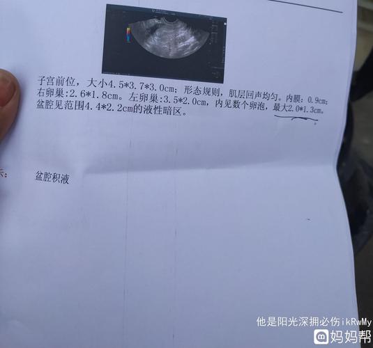 卵巢内有几个卵泡(正常情况下有几个卵泡）