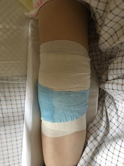 取环生育险能报销吗(取环可以享受生育险吗）