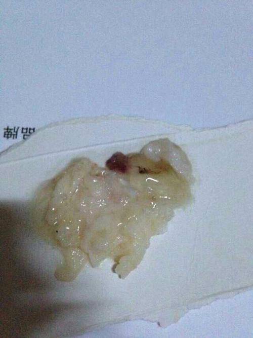 什么样的夫妻适合人工授精人工授精的孩子正常吗(男女都正常做人工授精成功率多少）