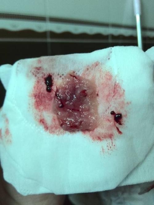 同房28天孕囊多大正常(受孕28天孕囊有多大）