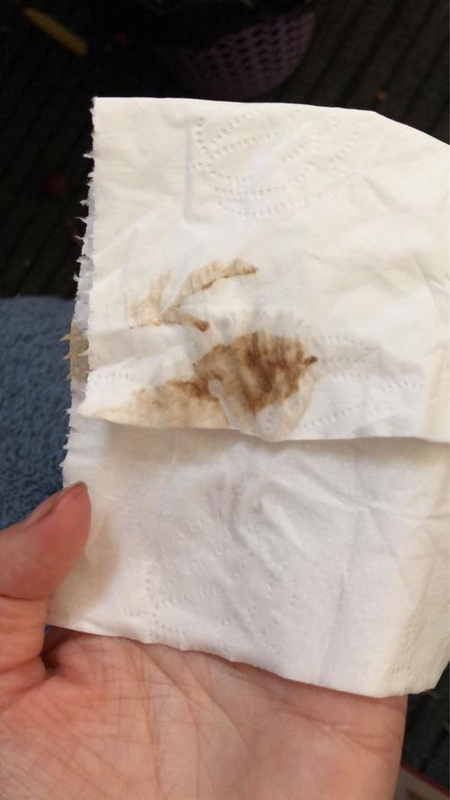 褐色分泌物怎么回事(女性流出咖啡色分泌物是怎么回事）