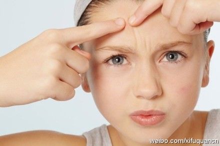 体寒的人容易长痘痘吗(为什么体寒的人容易长痘）