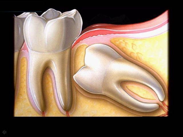 优生优育是什么意思(优生六项是检查什么)