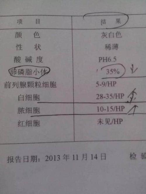 前列腺液是白色的吗前列腺液什么颜色才正常呢？(前列腺液什么时候分泌）