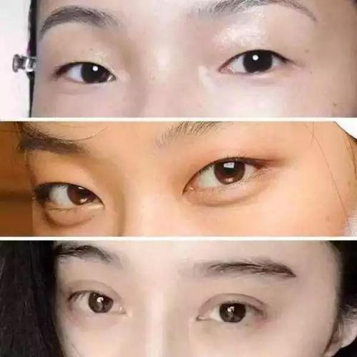 双眼皮的父母会生出单眼皮的孩子吗(单眼皮和内双的区别）