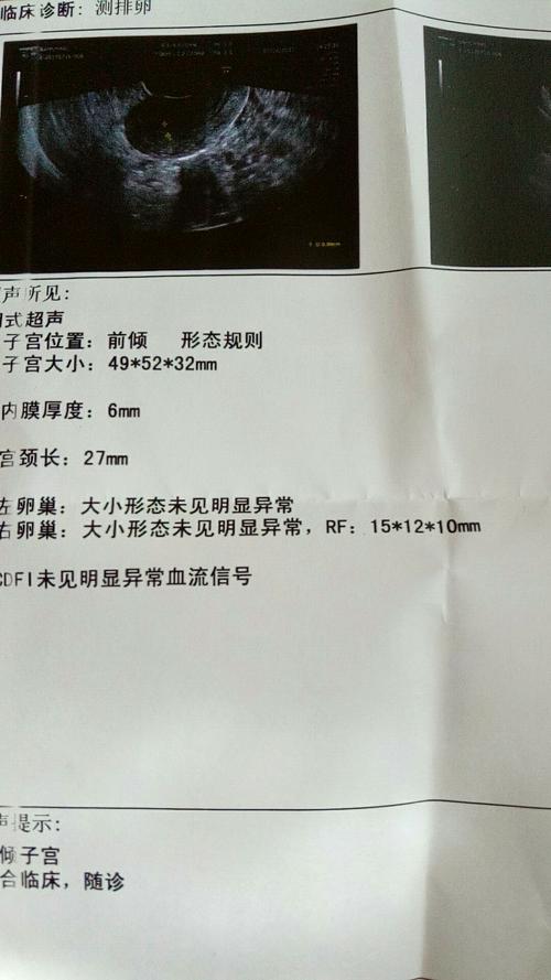 卵泡好几天不长正常吗(一侧卵巢只有一个卵泡正常吗）