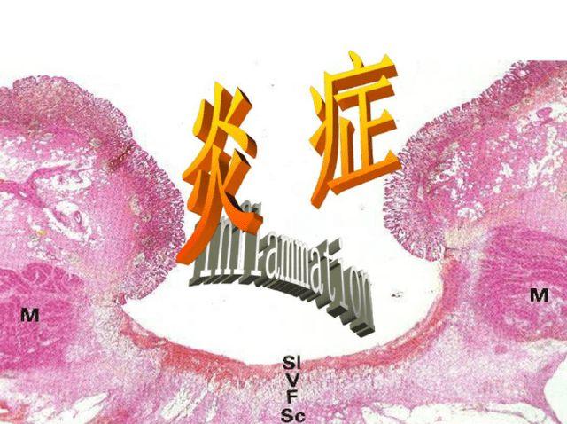 前列腺炎的中药配方(慢性前列腺炎中药治疗配方）