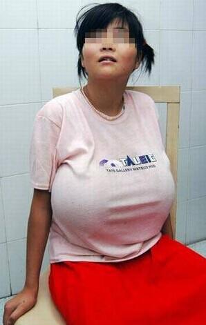 卵泡发育不成熟要怎么进行备孕如何避免卵泡发育不成熟(备孕压力大影响受孕吗）