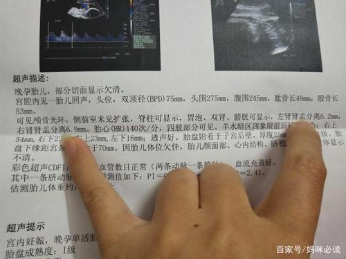 医生暗示宝宝头大是男是女孩子(三十一周男宝宝真实图片)