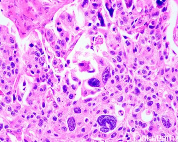吃黑豆真的可以助孕吗(备孕多吃黑豆容易受孕）