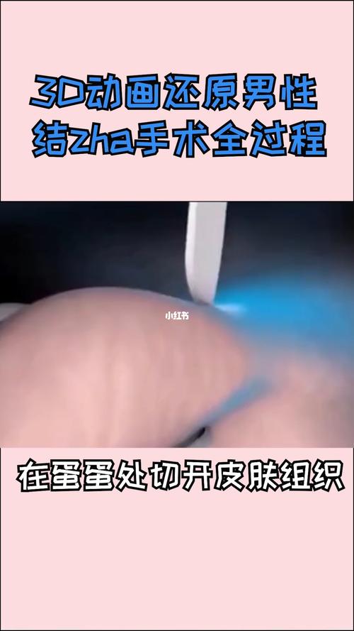 剖腹产结扎后会怀孕吗(剖宫产然后直接结扎有没有影响身体）