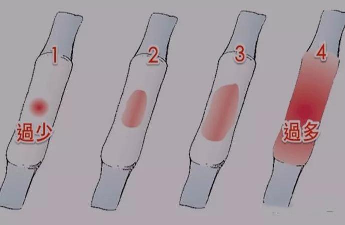 例假变少还可以怀孕吗(月经量少怀不了孕是什么原因）