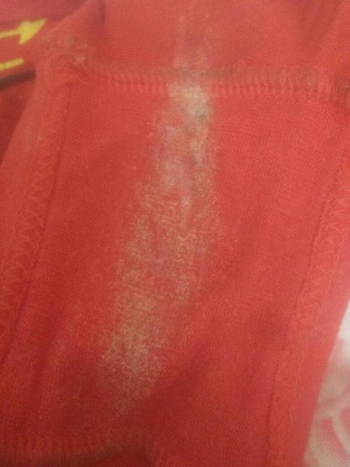 分泌物像水一样有异味是怎么回事(白带多像水打湿裤子有腥臭味)