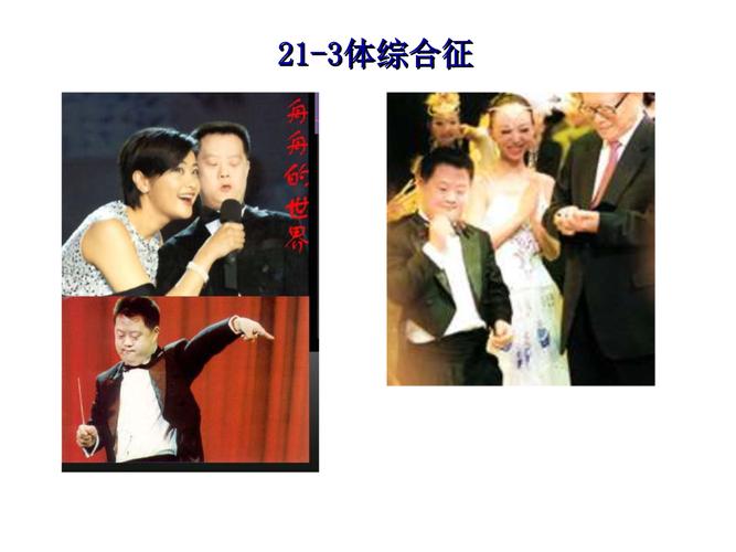 卵巢过度刺激综合征临床表现(重度卵巢过度刺激综合征的临床表现）