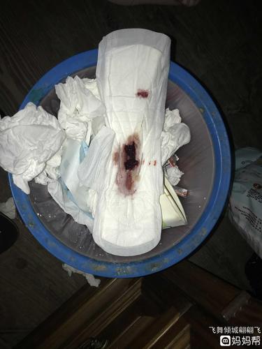 产后十八天恶露还有血块正常吗(产后恶露干净了又有血了怎么回事）