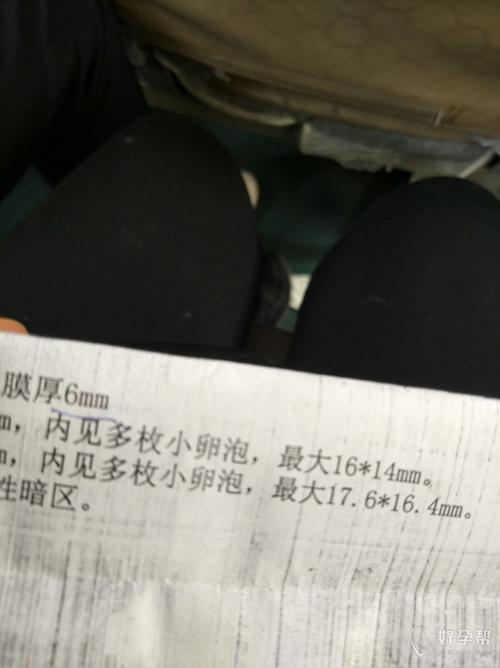 卵泡16mm排了受孕了吗(卵泡15mm会排卵吗）