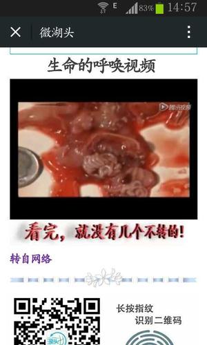 反复流产是什么意思?反复堕胎的五个常见答案(一个月内怎么堕胎)