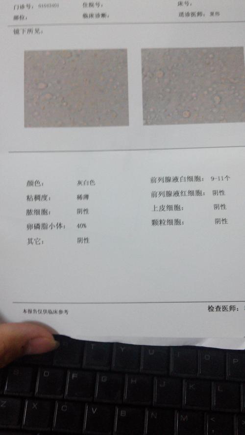 前列腺液是透明的吗你的前列腺液颜色正常吗？(正常前列腺液）