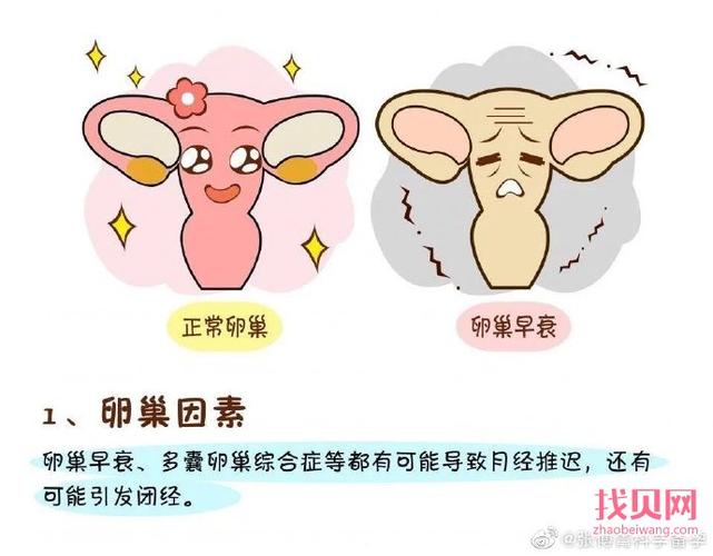 卵巢早衰可以吃乌鸡白凤丸吗(卵巢早衰有什么症状)