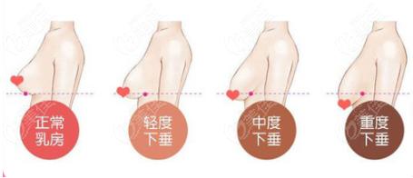 为什么做乳房保养(经常做乳房保养好不好)