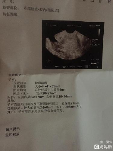 卵泡17乘11可以怀孕吗(卵泡17mm能正常受孕吗）