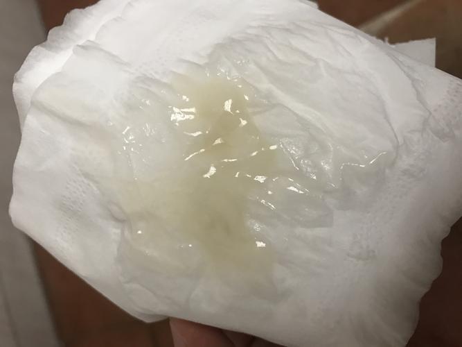 人流能恢复正常多久？他们能开始工作多久(打了胎多久能恢复像之前一样）