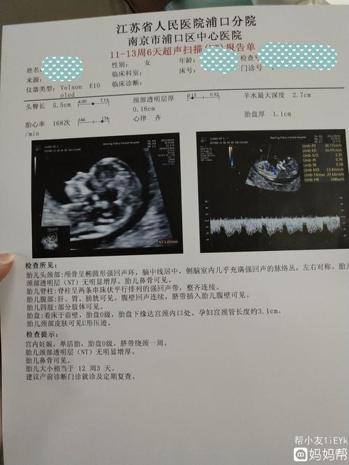 准备怀孕要做检查吗(怀孕做nt检查哪个部位)