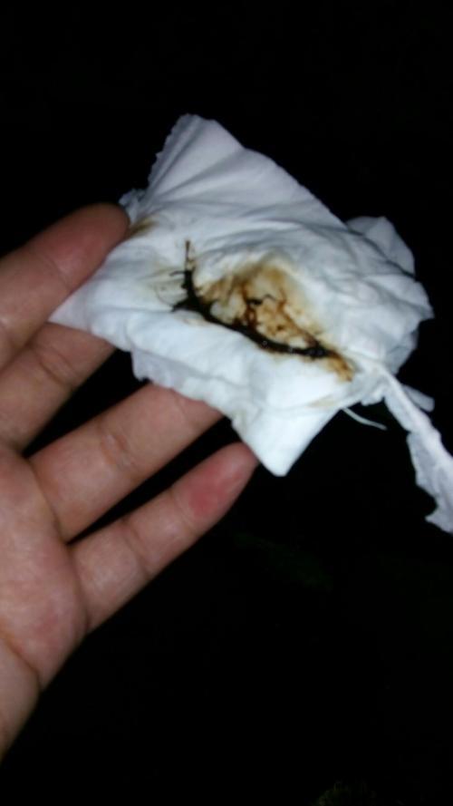 同房后多久能受孕成功(怀孕同房了出一些黑色怎么回事）