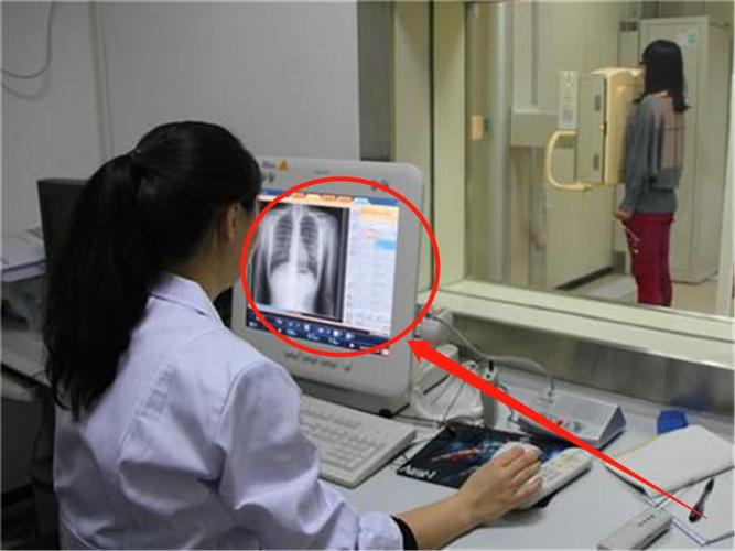 为什么很多女性不想做胸透？(女性胸透咋做）