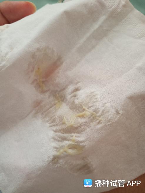 分泌物有酸味什么原因(白带有股醋一样的酸味正常吗)