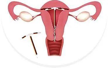 取环8个月了二胎怀不上怎么回事(取环半年了为什么一直怀不上）