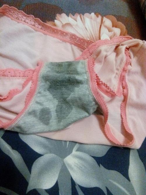 分泌物像水一样无味,正常吗(白带发黄内裤上干了像一层壳)