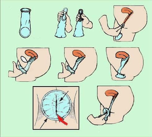 避孕套啥样咋用(避孕套怎么使用）