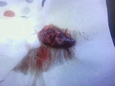 促排卵什么时候用药比较好促排卵药物都有哪些(促排卵药能生双胞胎吗）