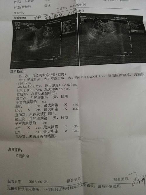 卵泡监测影响怀孕吗(排卵的过程卵泡会缩小）