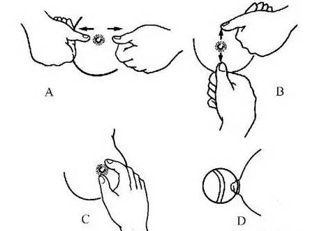 同房后8天乳房胀痛怎么回事(着床多久会胸胀胸疼）