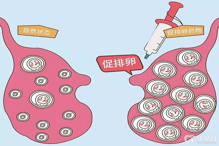 促排卵针会导致卵巢早衰吗(促排怀孕的成功率高吗）
