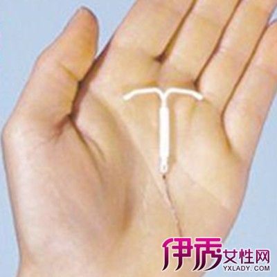 取环后会出血几天私处出血不要大意(取环后出血多是怎么回事）