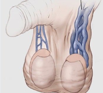 什么是男性原发不孕症(原发性不孕症严重吗）