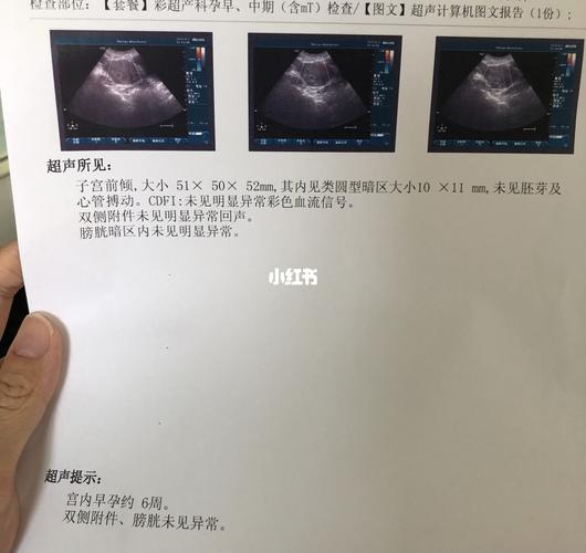 同房30天孕囊多大(同房即受孕20天孕囊有多大）