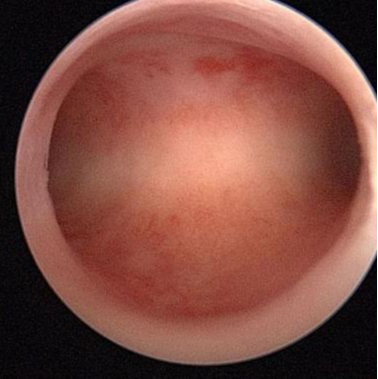 产后应避孕多久(产后如何避孕）