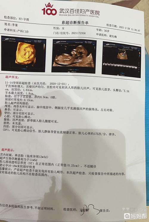 准备怀孕要做检查吗(怀孕做nt检查哪个部位)