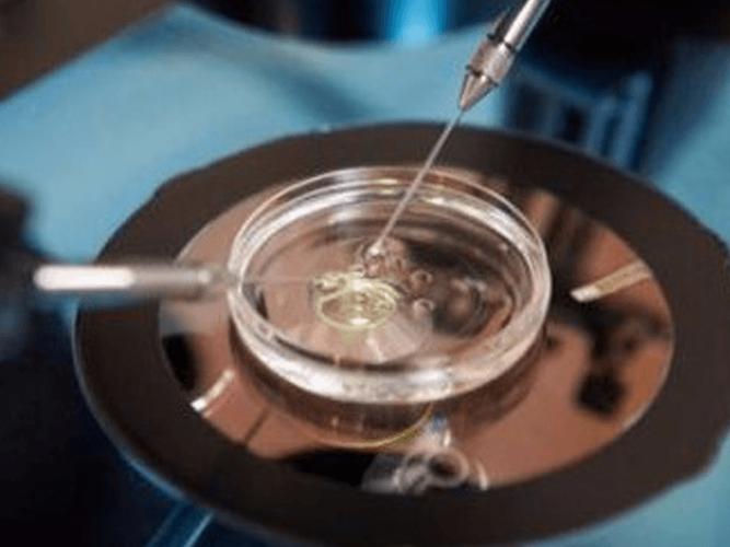 人工授精能选性别吗胎儿性别不是迷(人工授精能知道男孩女孩吗）