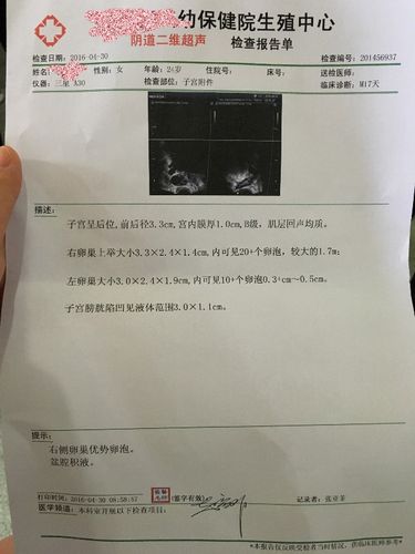 卵巢功能好不好？这些检查都知道！(卵巢怎么检查是否正常）