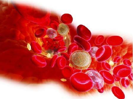 什么血型要做溶血(RH血型不合溶血病）